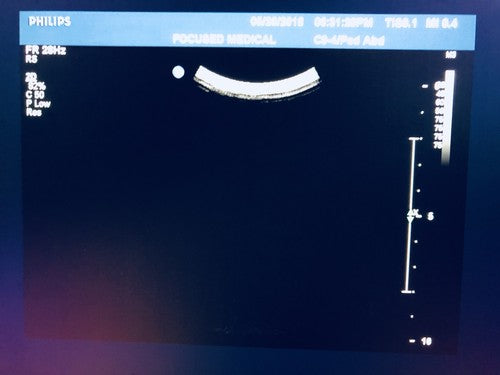 PHILIPS  C9-4 Ultrasound Transducer Probe