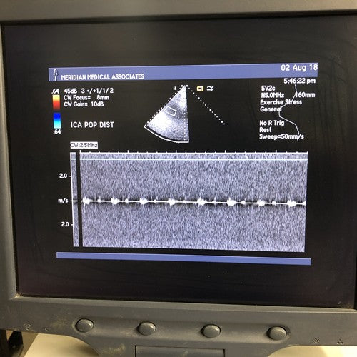 Siemens Acuson 5V2c Probe Transducer For Sequoia C512 (For Parts)