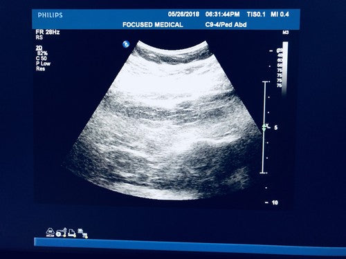 PHILIPS  C9-4 Ultrasound Transducer Probe