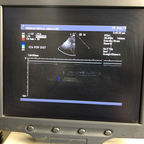 Siemens Acuson 5V2c Probe Transducer For Sequoia C512 (For Parts)