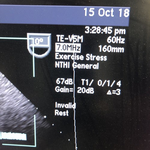 SIEMENS Acuson TE-V5Ms Transesophageal Ultrasound Transducer Probe