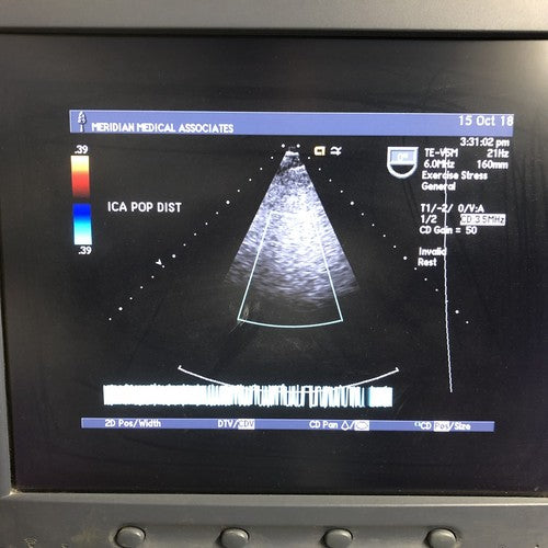 SIEMENS Acuson TE-V5Ms Transesophageal Ultrasound Transducer Probe