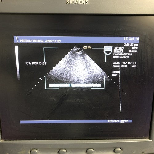 SIEMENS Acuson TE-V5Ms Transesophageal Ultrasound Transducer Probe