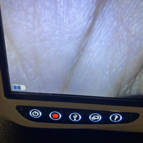 Verathon Glidescope 0570-0307 AVL 3-4 Baton Camera Blade Clear Image