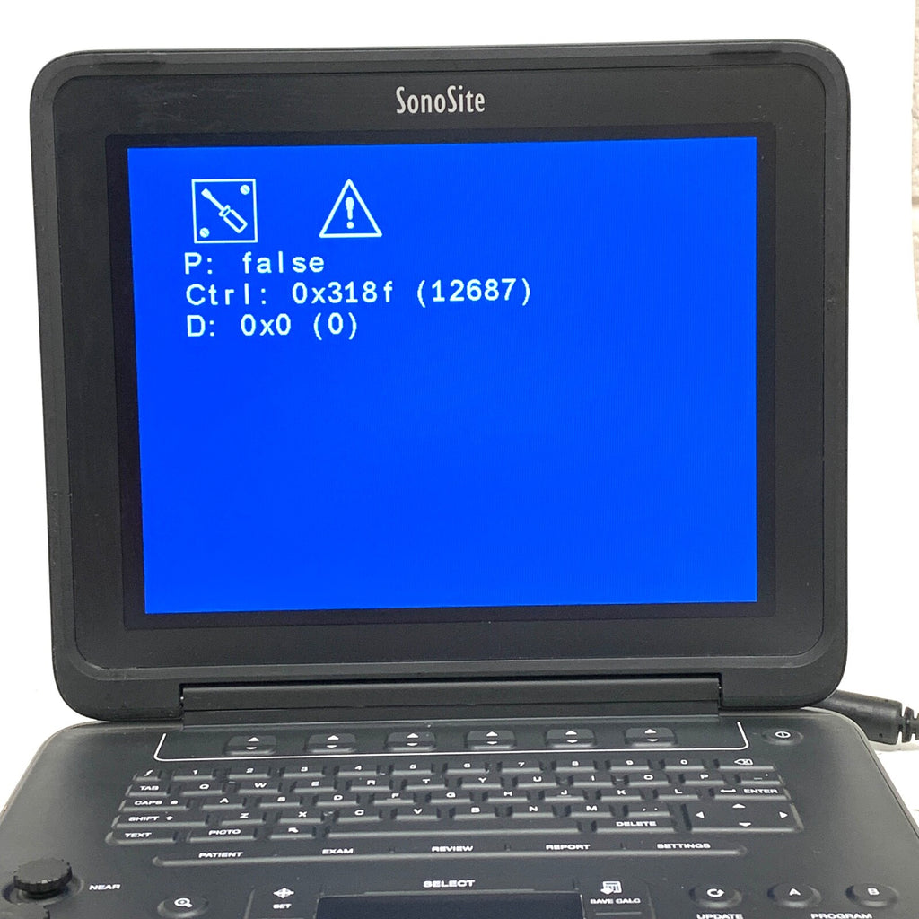 Sonosite REF P20680-18, Edge II Ultrasound System, w/ P15078-41 Edge Mini Dock