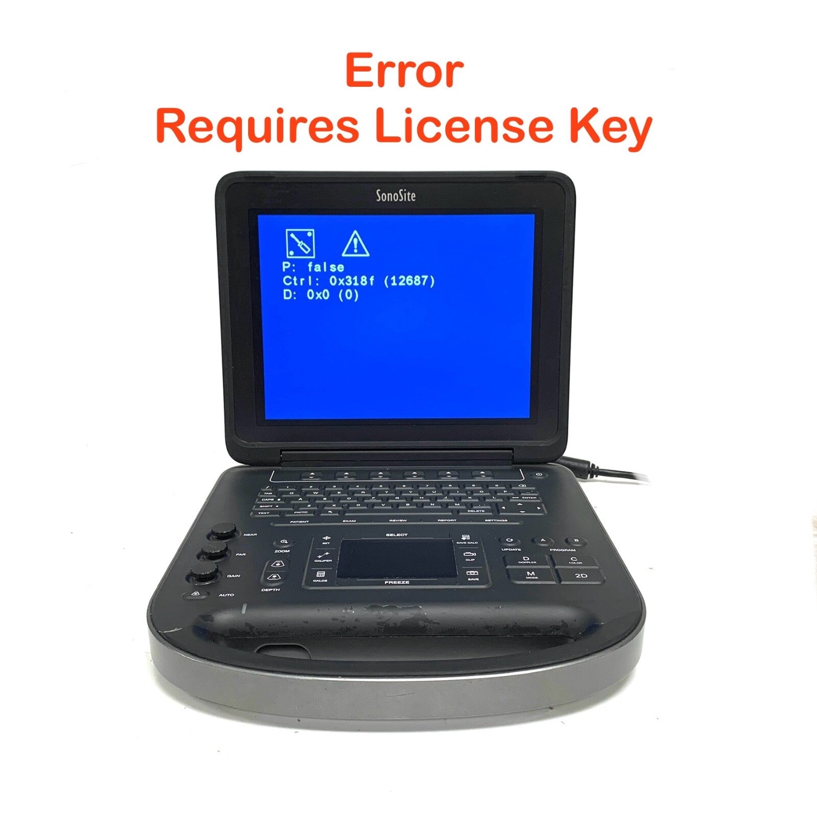 Sonosite REF P20680-18, Edge II Ultrasound System, w/ P15078-41 Edge Mini Dock