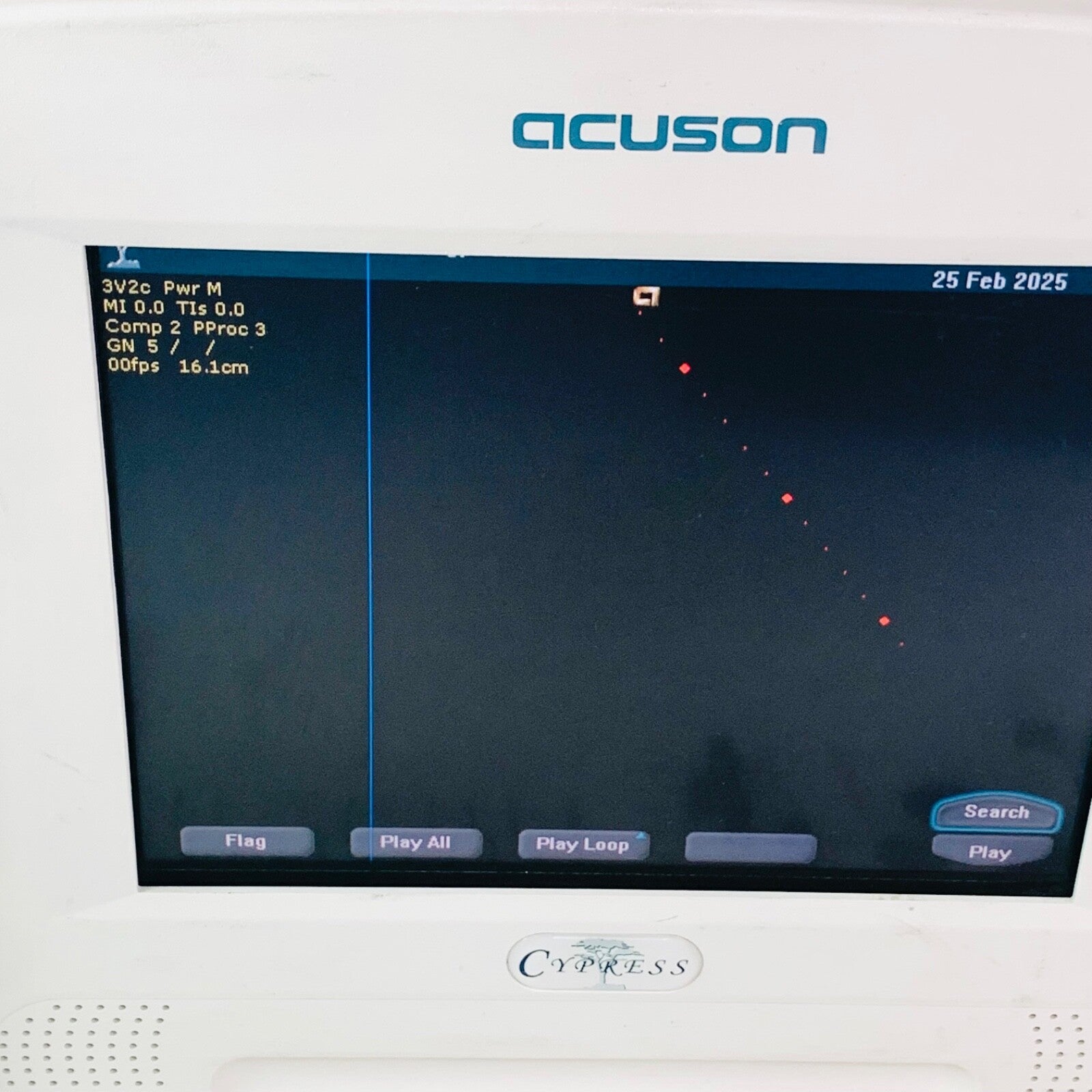 Acuson Cypress Ultrasound System with 7V3C, 3V2C Transducer