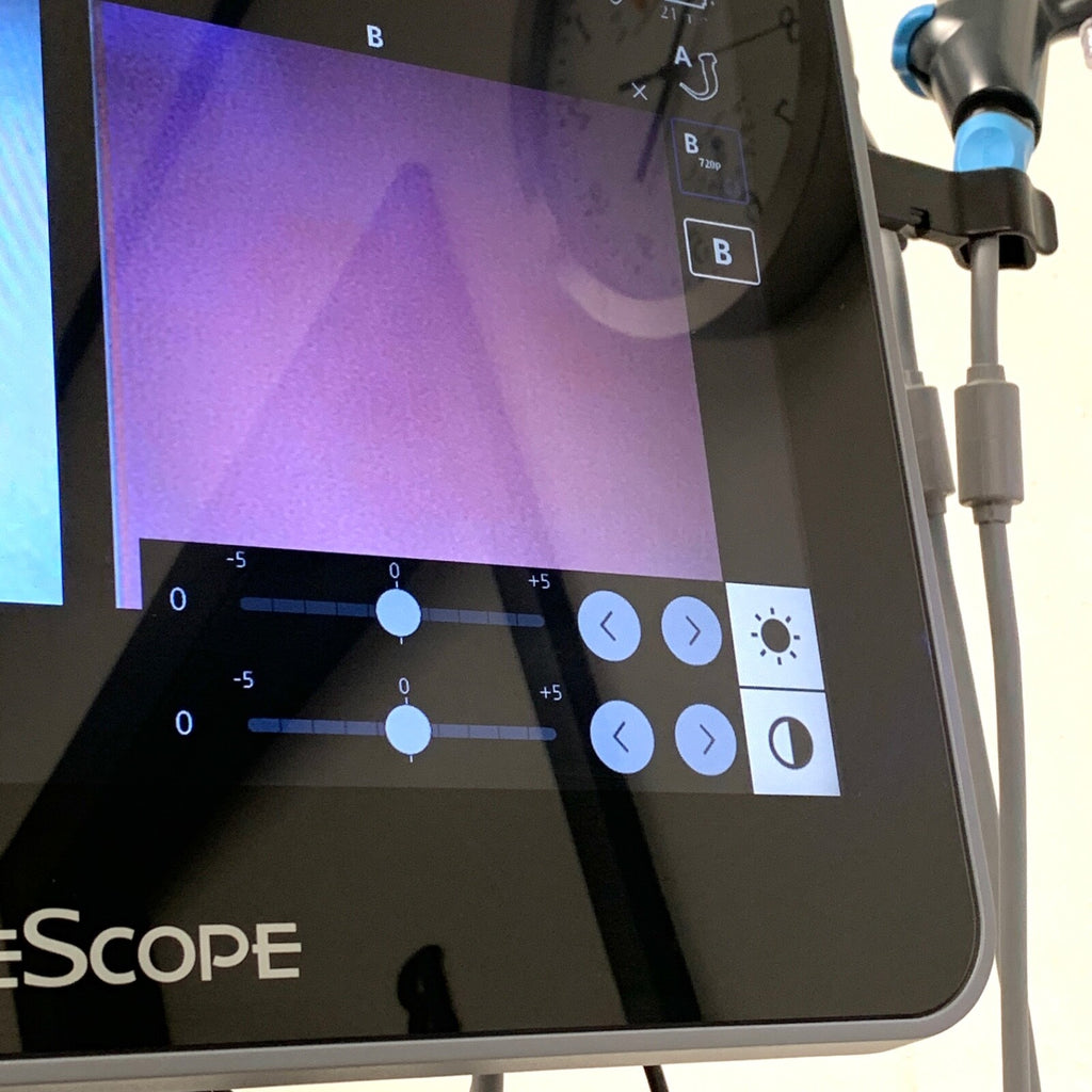 Glidescope Core 15, REF 0570-0404, Video Laryngoscope System w/ A/B Smart Cables