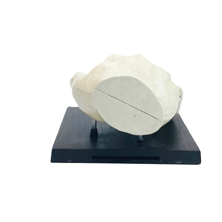 INDOCIN MERCK SHARP & DOHME INDOMETHACIN ANATOMICAL HUMAN HAND