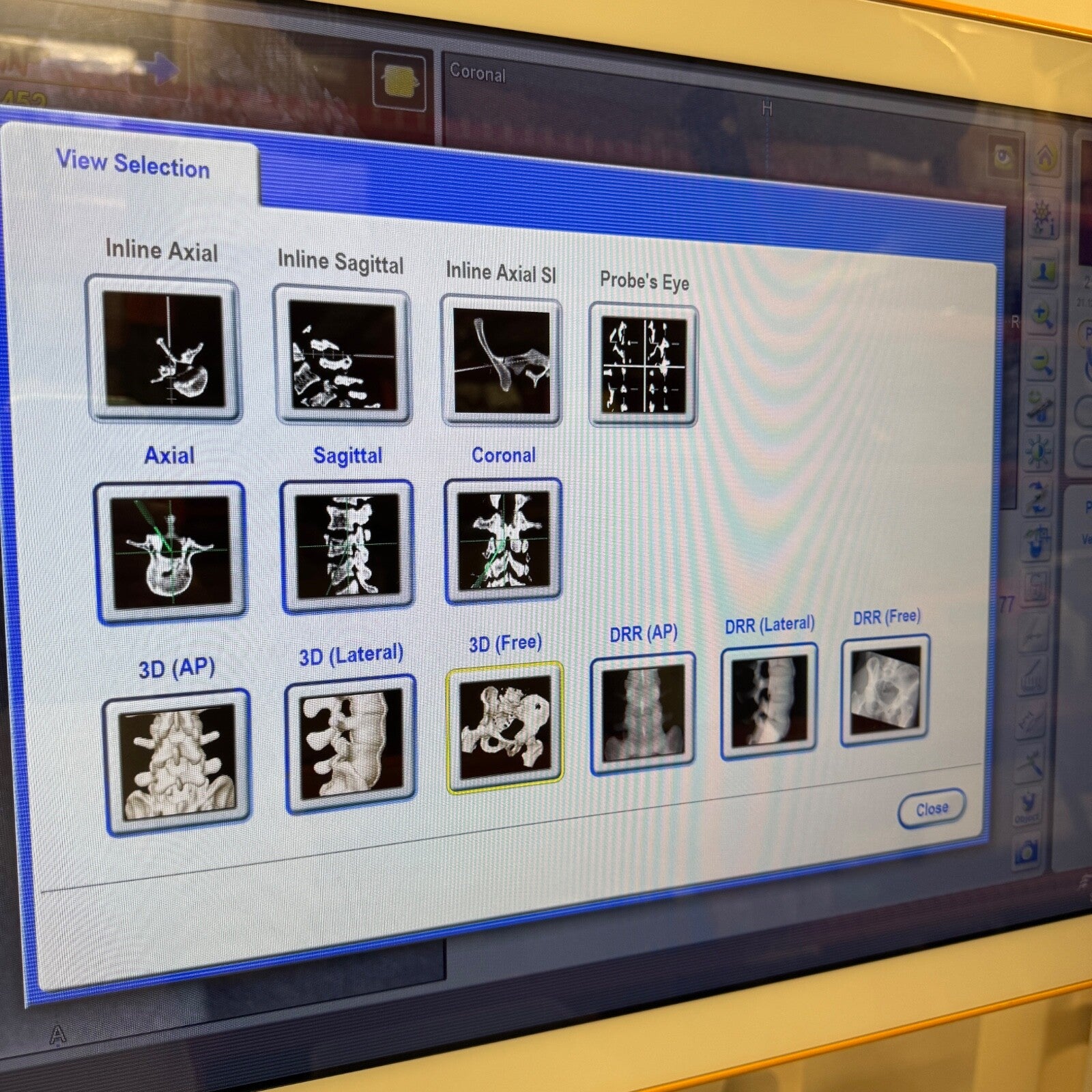BRAINLAB 19901 Curve 1.1 Dual Navigation System w/ Curve Dual Navigation Station