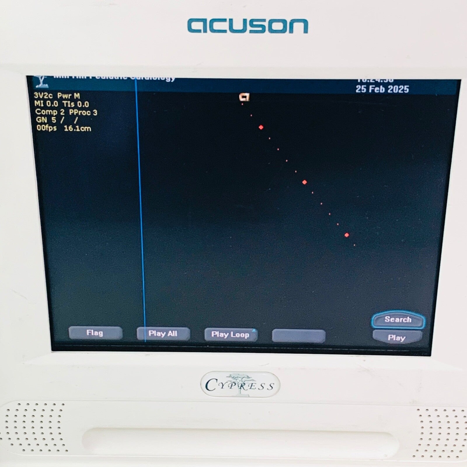 Acuson Cypress Ultrasound System with 7V3C, 3V2C Transducer